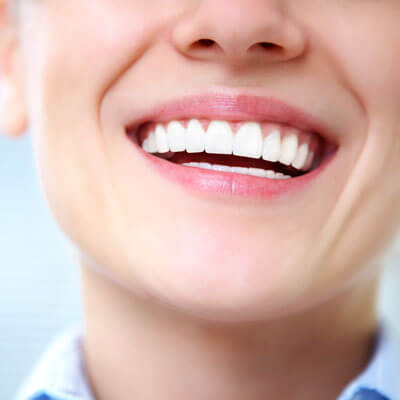 closeup-teeth-laughing-woman-sq-400