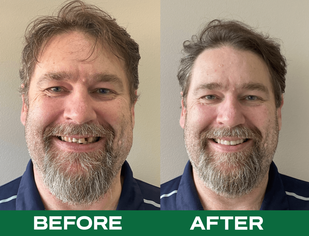 Happy dental patient with smile transformation