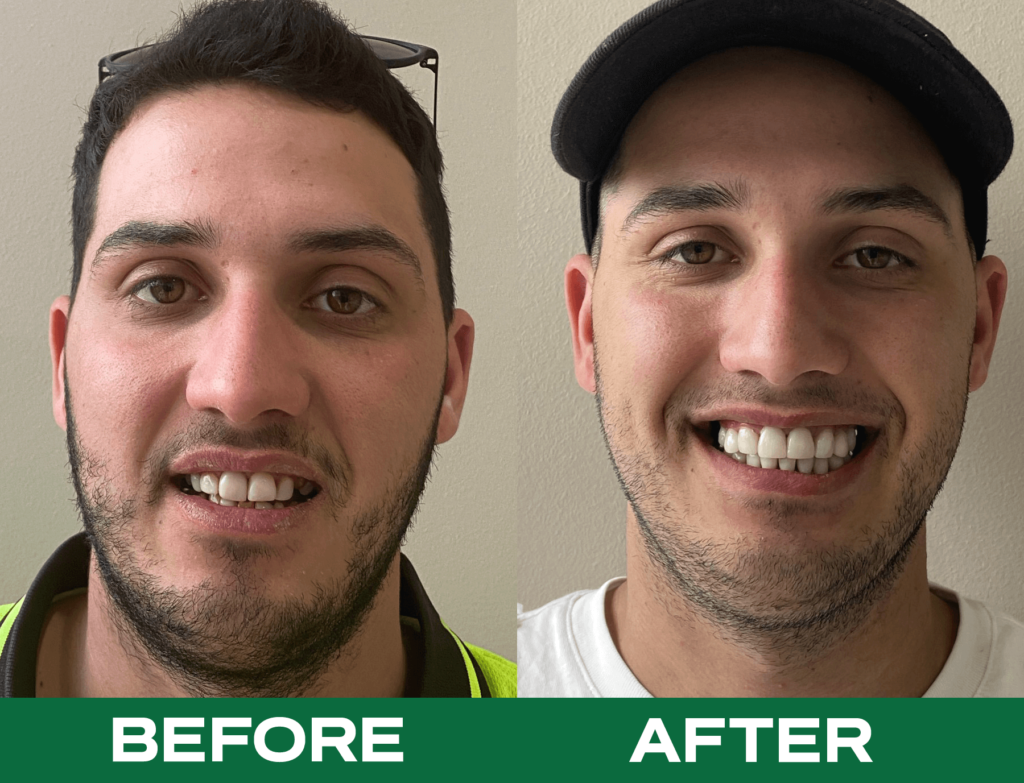 Dental treatment visual or process illustration