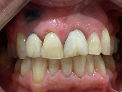 Frame layout presenting smile makeover results