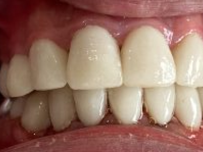Dental services promotional frame layout