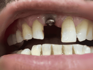 Dentist performing oral check-up on patient (Image 3)