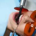 From Anxiety to Assurance: The Psychology of a Pain-Free Root Canal
