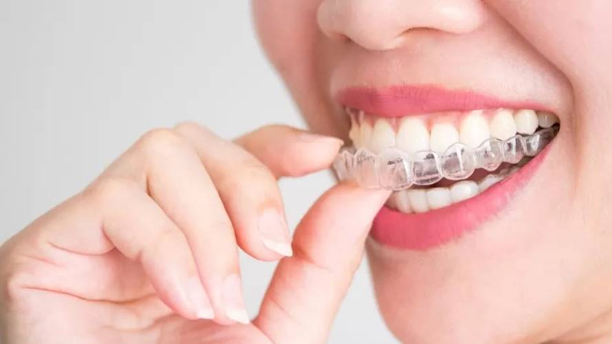 Invisalign clear aligners for comfortable teeth straightening